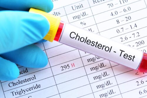 Ciri dan Gejala Kolesterol Tinggi yang Tidak Boleh Diabaikan 1