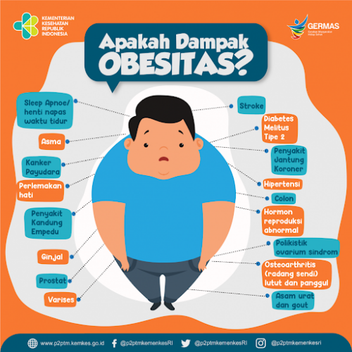 Pengertian, Bahaya Obesitas & Komplikasinya 1